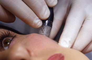 Silkpeel